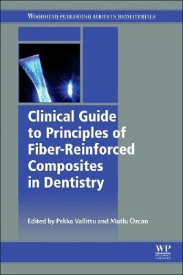 Clinical Guide to Principles of Fiber-Reinforced Composites in Dentistry - 