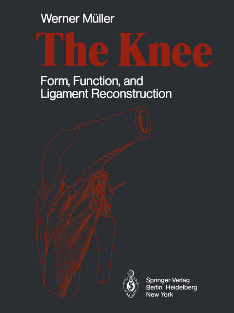 The Knee - W. Müller