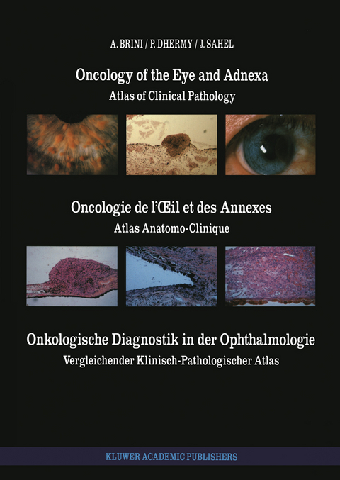 Oncology of the Eye and Adnexa / Oncologie de l’Œil et des Annexes / Onkologische Diagnostik in der Ophthalmologie - A. Brini, A. Dhermy, J. Sahel