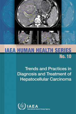 Trends and Practices in Diagnosis and Treatment of Hepatocellular Carcinoma -  Iaea