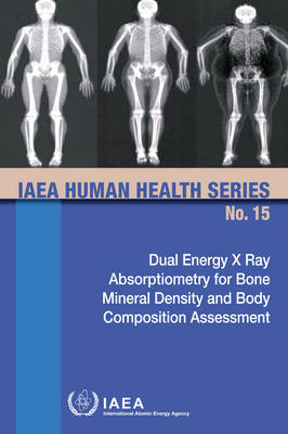 Dual Energy X Ray Absorptiometry for Bone Mineral Density and Body Composition Assessment -  Iaea