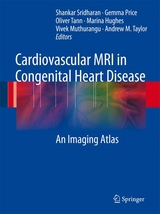 Cardiovascular MRI in Congenital Heart Disease -  Shankar Sridharan,  Gemma Price,  Oliver Tann,  Marina Hughes,  Vivek Muthurangu,  Andrew M. Taylor