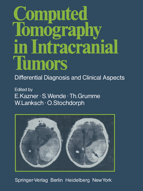 Computed Tomography in Intracranial Tumors - G.B. Bradac, U. Büll, R. Fahlbusch, Th. Grumme, E. Kazner, K. Kretzschmar, W. Lanksch, W. Meese, J. Schramm, H. Steinhoff, O. Stochdorph, S. Wende