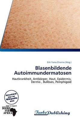 Blasenbildende Autoimmundermatosen - 