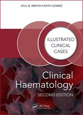 Clinical Haematology - Atul Bhanu Mehta, Keith Gomez