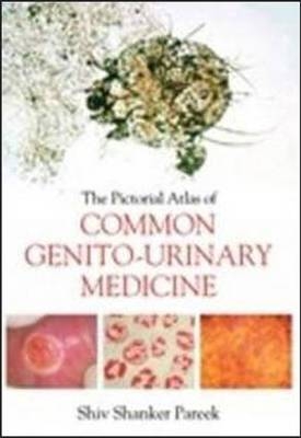 The Pictorial Atlas of Common Genito-Urinary Medicine - Shiva Pareek