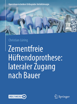 Zementfreie Hüftendoprothese: lateraler Zugang nach Bauer - Christian Lüring