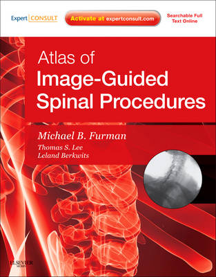 Atlas of Image-Guided Spinal Procedures - 