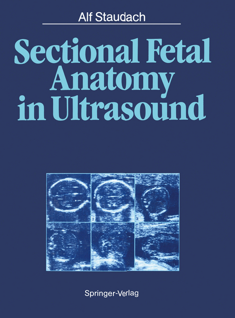 Sectional Fetal Anatomy in Ultrasound - Alf Staudach