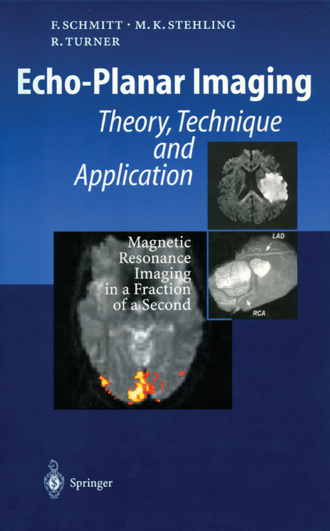 Echo-Planar Imaging - Franz Schmitt, Michael K. Stehling, Robert Turner