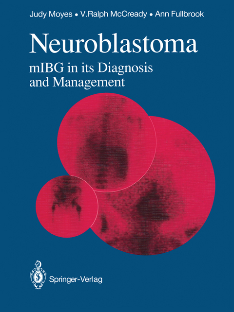 Neuroblastoma - Judy S.E. Moyes, V. Ralph McCready