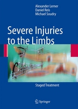 Severe Injuries to the Limbs - Alexander Lerner, Daniel Reis, Michael Soudry