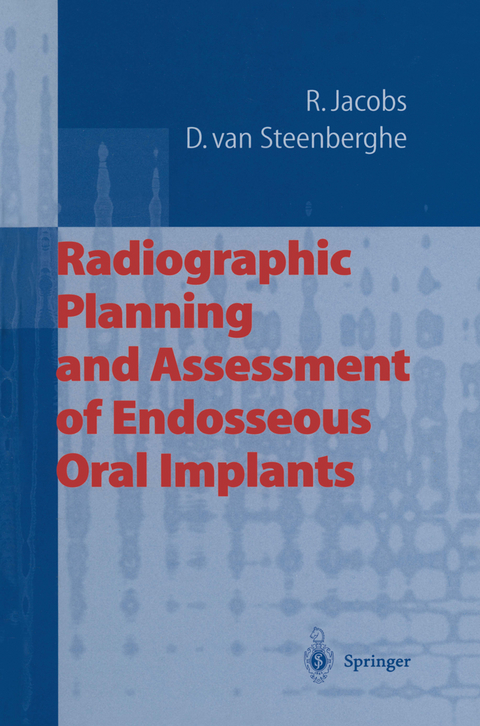 Radiographic Planning and Assessment of Endosseous Oral Implants - Reinhilde Jacobs, Daniel van Steenberghe