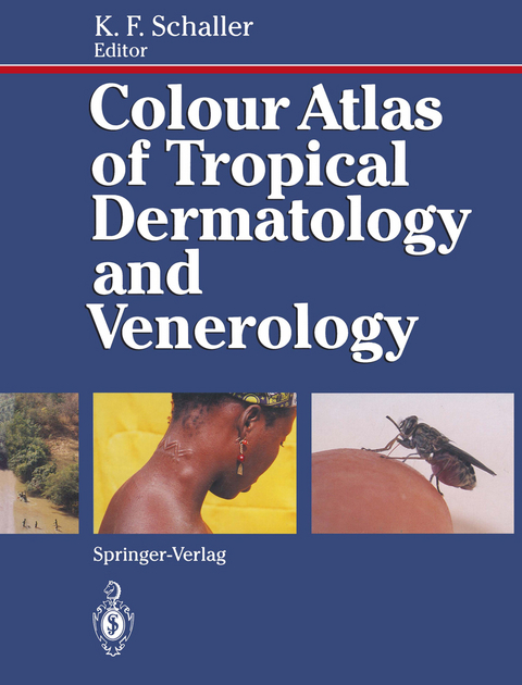 Colour Atlas of Tropical Dermatology and Venerology - 