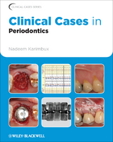 Clinical Cases in Periodontics - 