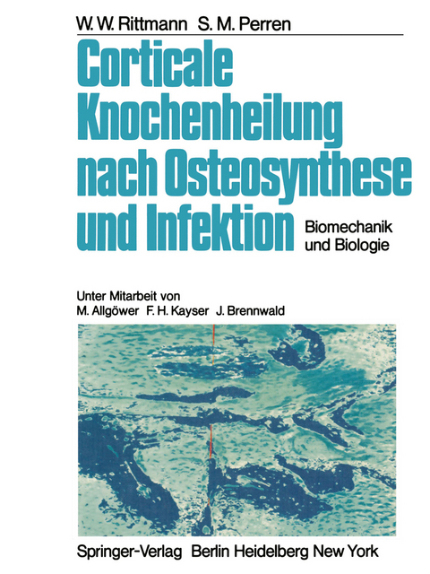Corticale Knochenheilung nach Osteosynthese und Infektion - W.W. Rittmann, S.M. Perren