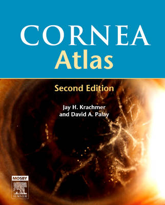 Cornea Atlas - Jay H. Krachmer, David A. Palay