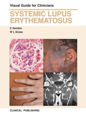 Systemic Lupus Erythematosus - C. Gordon, W. L. Gross