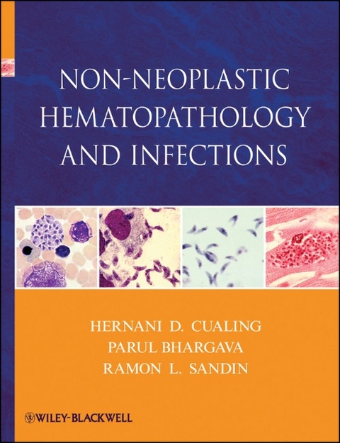Non-Neoplastic Hematopathology and Infections - Hernani Cualing, Parul Bhargava, Ramon L. Sandin