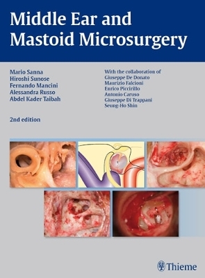 Middle Ear and Mastoid Microsurgery - Hiroshi Sunose, Alessandra Russo, Abdelkader Taibah, Fernando Mancini, Mario Sanna