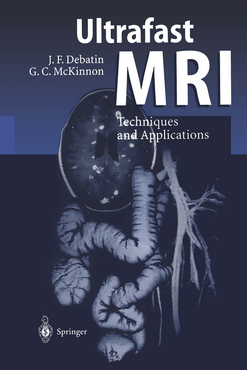 Ultrafast MRI - Jörg F. Debatin, Graeme C. McKinnon