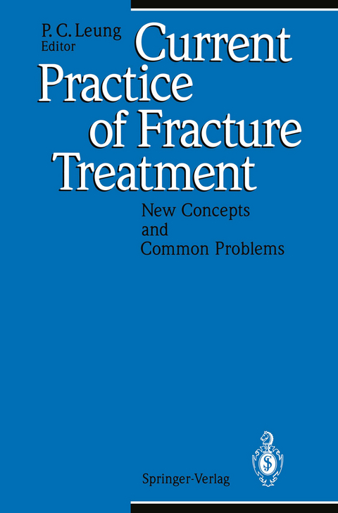 Current Practice of Fracture Treatment - 