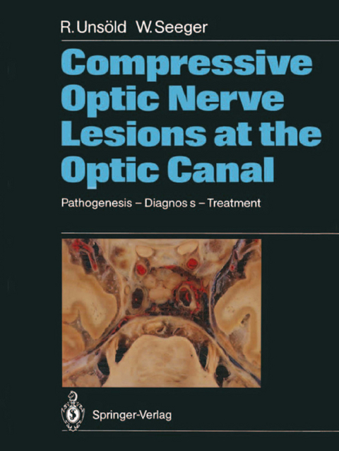 Compressive Optic Nerve Lesions at the Optic Canal - Renate Unsöld, Wolfgang Seeger