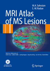 MRI Atlas of MS Lesions - M.A. Sahraian, Ernst-Wilhelm Radü