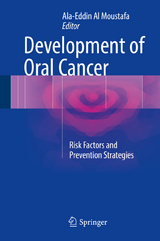 Development of Oral Cancer - 