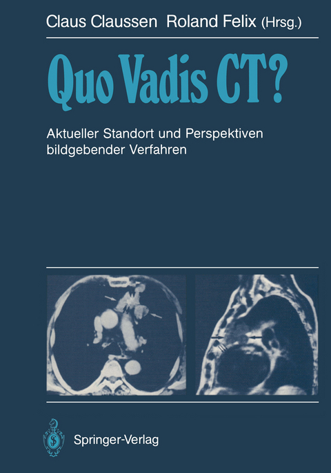 Quo Vadis CT? - 