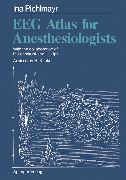 EEG Atlas for Anesthesiologists - Ina Pichlmayr