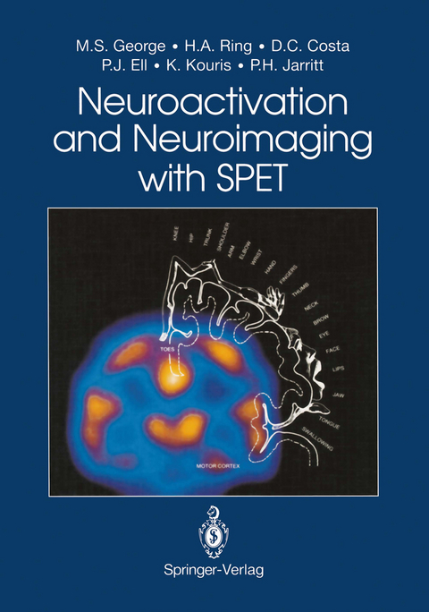 Neuroactivation and Neuroimaging with SPET - Mark S. George, Howard A. Ring, Durval C. Costa, Peter J. Ell, Kypros Kouris