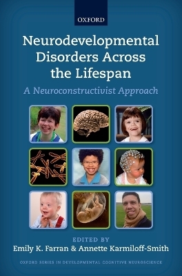 Neurodevelopmental Disorders Across the Lifespan - 