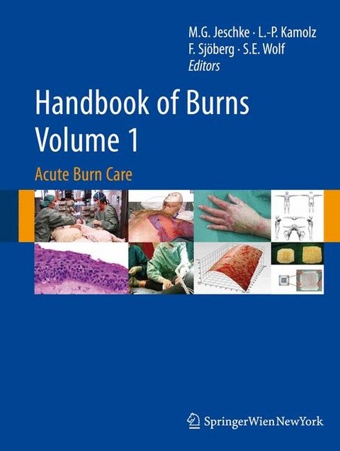 Handbook of Burns Volume 1 - 
