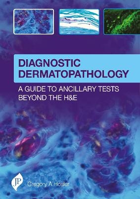 Diagnostic Dermatopathology: A Guide to Ancillary Tests Beyond the H&E - Gregory a Hosler