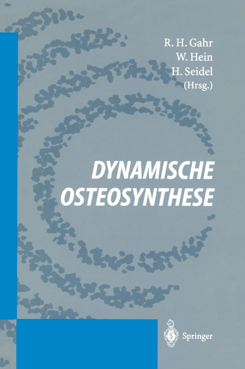 Dynamische Osteosynthese - 