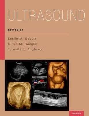 Ultrasound - 