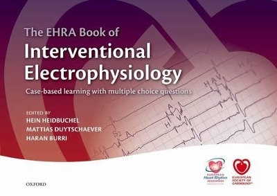 The EHRA Book of Interventional Electrophysiology - 