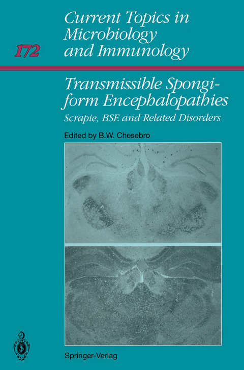 Transmissible Spongiform Encephalopathies: - 