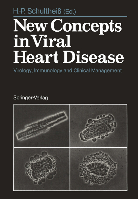 New Concepts in Viral Heart Disease - 