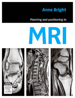 Planning and Positioning in Mri - E-Book - Anne Bright