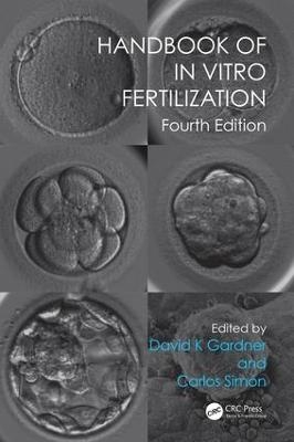Handbook of In Vitro Fertilization - 