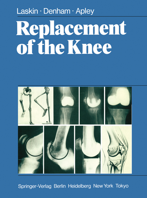 Replacement of the Knee - R.S. Laskin, R.A. Denham, A.G. Apley