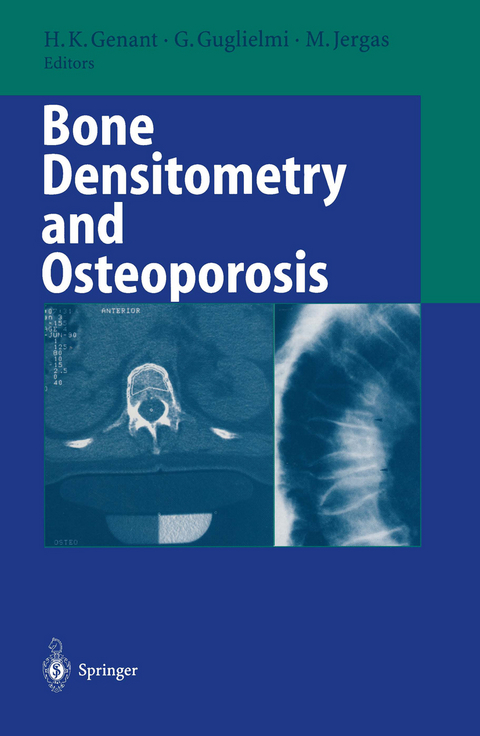 Bone Densitometry and Osteoporosis - 