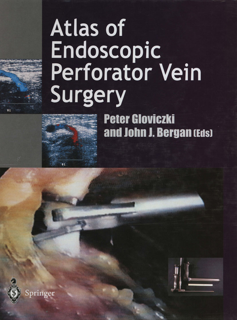 Atlas of Endoscopic Perforator Vein Surgery - 
