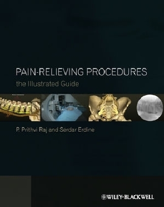 Pain-Relieving Procedures - P. Prithvi Raj, Serdar Erdine