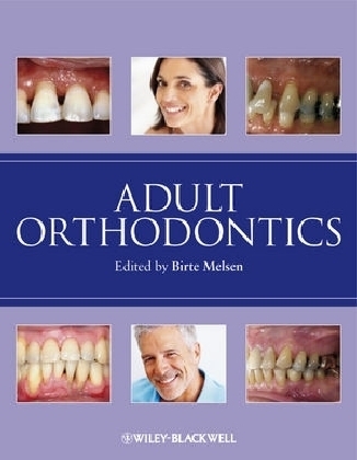 Adult Orthodontics - B Melsen