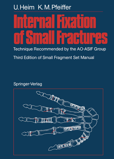 Internal Fixation of Small Fractures - Urs Heim, Karl M. Pfeiffer