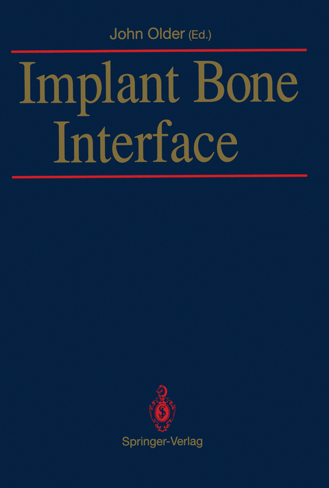 Implant Bone Interface - 