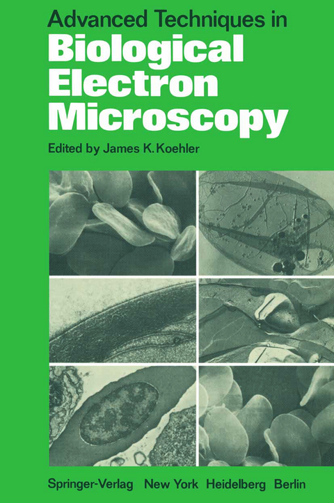 Advanced Techniques in Biological Electron Microscopy - 